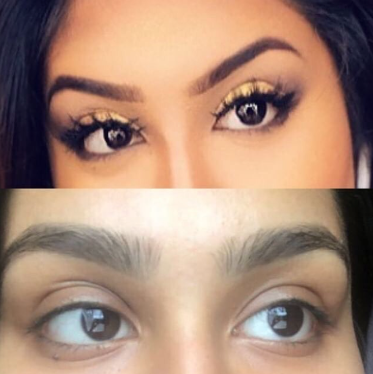 Eyebrow growth