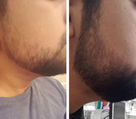 6 Weeks Progress